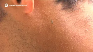 Spread is increasing: Tiger mosquitoes are once again more prevalent in Middle Franconia