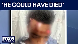 DeKalb mother begs for answers after son hit while on skates | FOX 5 News
