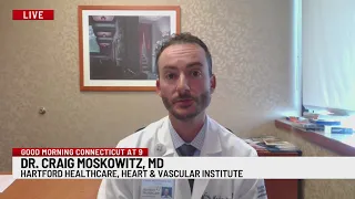 What to know about A-Fib: Signs, risks and treatment