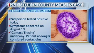 Steuben County officials confirm second measles case