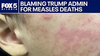 Governor blames Trump Admin for measles deaths | FOX 5 News