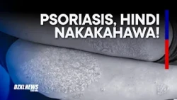 “PSORIASIS, HINDI NAKAKAHAWA!” —Psoriasis Philippines