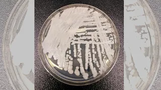 Drug-resistant fungus Candida auris spreading across US, doctor says healthy people face low risk