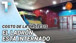 La PROVINCIA PAGARÁ la PRÓTESIS del LADRÓN BALEADO: el procedimiento en el Hospital de Urgencias La PROVINCIA PAGARÁ la PRÓTESIS del LADRÓN BALEADO: el procedimiento en el Hospital de Urgencias