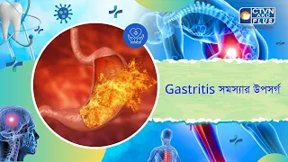 Gastritis সমস্যার উপসর্গ। Health and Wellness