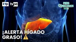 ¿Tienes hígado graso y no lo sabes? Esto debes conocer | Más conectados