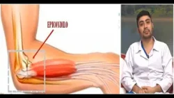 Qué es el codo de tenista, síntomas y tratamientos de la epicondilitis