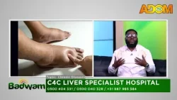 C4C Liver Specialist Hospital - Badwam Afisem on Adom TV (09-03-26)