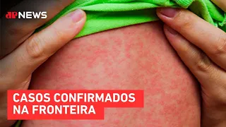 Amazonas confirma três casos de sarampo em Tabatinga