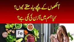 Ferritin Face: Signs of Iron Deficiency Explained | Nawaiwaqt |