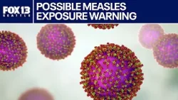 Сообщается о возможном заражении корью в Бельвью, Сиэтле и на линии легкорельсового транспорта.