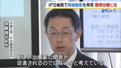 難病治療に光　ｉＰＳ細胞で「特発性肺線維症」の発症メカニズムの一端解明「新しい治療薬の開発が促進されるのではないか」　京都大学（2026年2月13日）