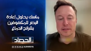 ماسك يحاول إعادة البصر للمكفوفين بشرائح الدماغ | روابط