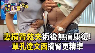 台中妻「捐腎救夫」留下最美傷痕！「單孔達文西」摘腎更精準 術後2天無痛康復【東森醫起看】