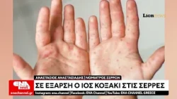 Έξαρση του ιού Κοξάκι στις Σέρρες: Ποια τα συμπτώματα και η αντιμετώπιση