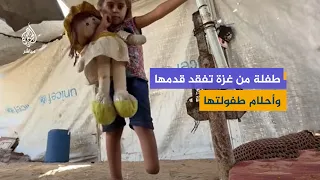 From Play to a Tent.. A Gaza Child Faces Life with One Leg