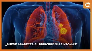 LUNG CANCER