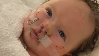Special birthday celebration planned for Larkspur toddler