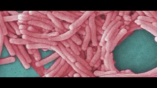 Mayor Mamdani announces new measures to combat Legionnaires' disease