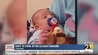 Baby in coma after alleged shaking