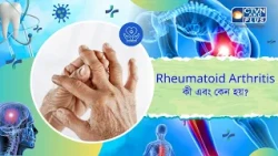 Rheumatoid Arthritis কী এবং কেন হয়। Health and Wellness