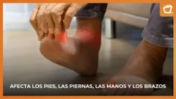 Diabetic Neuropathy: When Diabetes Affects the Nerves