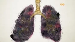 Az EFI szakemberei kiemelten fontosnak tartják a dohányzásról leszokást segítő programot