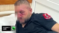 Top Channel/ Dhjetëra të lënduar në protestë. Në spital mbi 50 policë, protestues dhe një kalimtar
