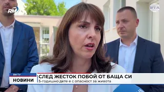 RM TV: След жесток побой от баща си 5-годишно дете е с опасност за живота (Обновен)