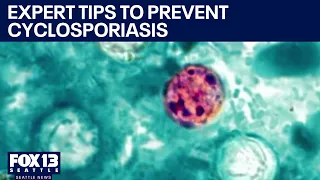Tips for avoiding the cyclosporiasis parasite | FOX 13 Seattle