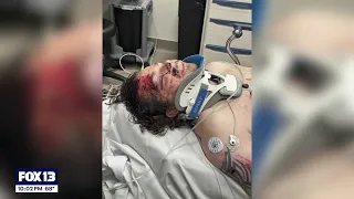Newlywed fighting for his life after e-scooter, bus crash