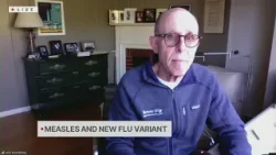 Measles confirmed in East Bay