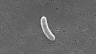 Pinellas County resident dies after contracting 'rare' flesh-eating bacteria