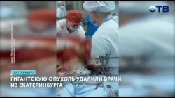 Уральские хирурги удалили гигантскую опухоль весом в 60 килограммов