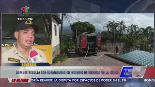 Man sustains burns in structural fire in La Ceiba