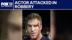 'Pretty Little Liars' actor attacked in LA robbery