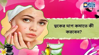 ত্বকের দাগ কমাতে কী করবেন। Beauty