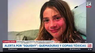 Alerta por “Squishy”: quemaduras y copias tóxicas