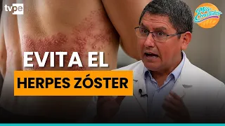 Herpes zóster: ¿Cómo detectarlo y tratarlo a tiempo?