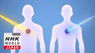 Proton Beam Therapy for Cancer: Preserving Quality of Life - Medical Frontiers