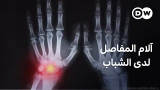 آلام المفاصل في سن مبكرة. ما الأسباب؟ | صحتك بين يديك