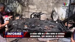 Niña de 3 años sufre de severas quemaduras, tras incendio de su vivienda en La Ceiba, Atlántida