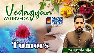 Tumors | DR. SULTAN KHAN