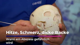 When toothaches become dangerous | Sachsen Fernsehen