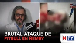 Brutal ataque de pitbull en Ñemby Brutal ataque de pitbull en Ñemby