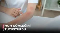 Arkadaşına doğum günü sürprizi yapmak isterken kolu yandı