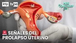 ⚠️ Prolapso uterino: señales de alerta que no debes ignorar | “Más conectados”