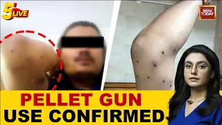 Delhi Student Protest: Medical Records Confirm Pellet Gun Use as Injured Protesters Seek Treatment