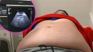 "NUNCA ME LO HICE": la primera ecografía abdominal de Micaela en su vida, para detectar hígado graso