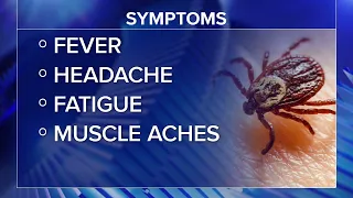3 probable cases of 'rabbit fever' reported in New York. Here's what to know